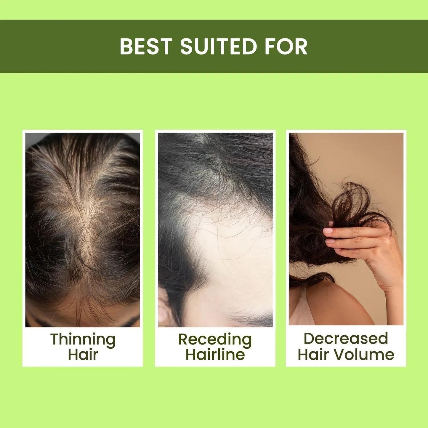 Hair Regrowth Water Spray with Rosemary Extract – Buy 1 Get 2 Free (Pack of 3 x 100ml)