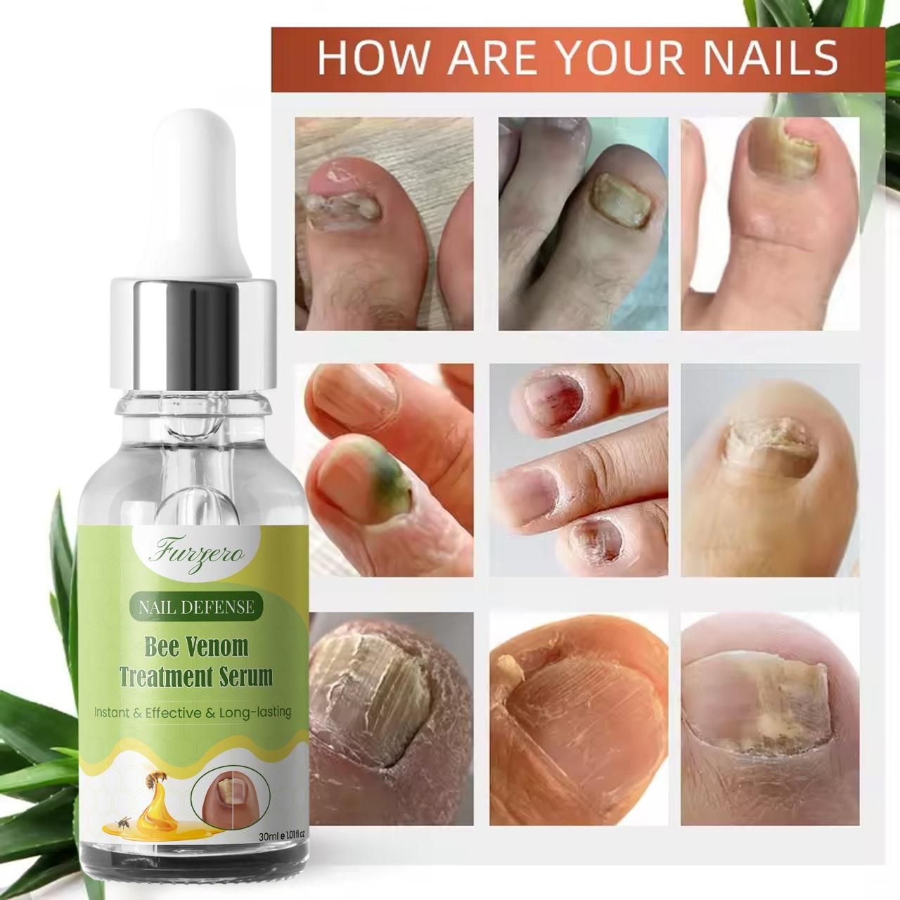 Furgero Nail Defense Bee Venom Treatment Serum – Strengthening & Repairing Formula | Pack of 1 / Pack of 2
