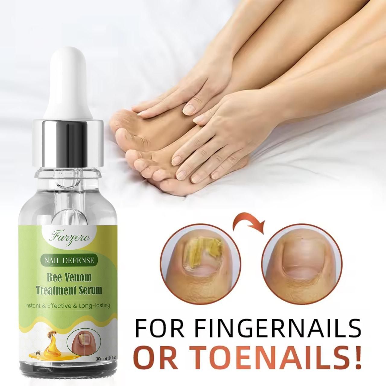 Furgero Nail Defense Bee Venom Treatment Serum – Strengthening & Repairing Formula | Pack of 1 / Pack of 2